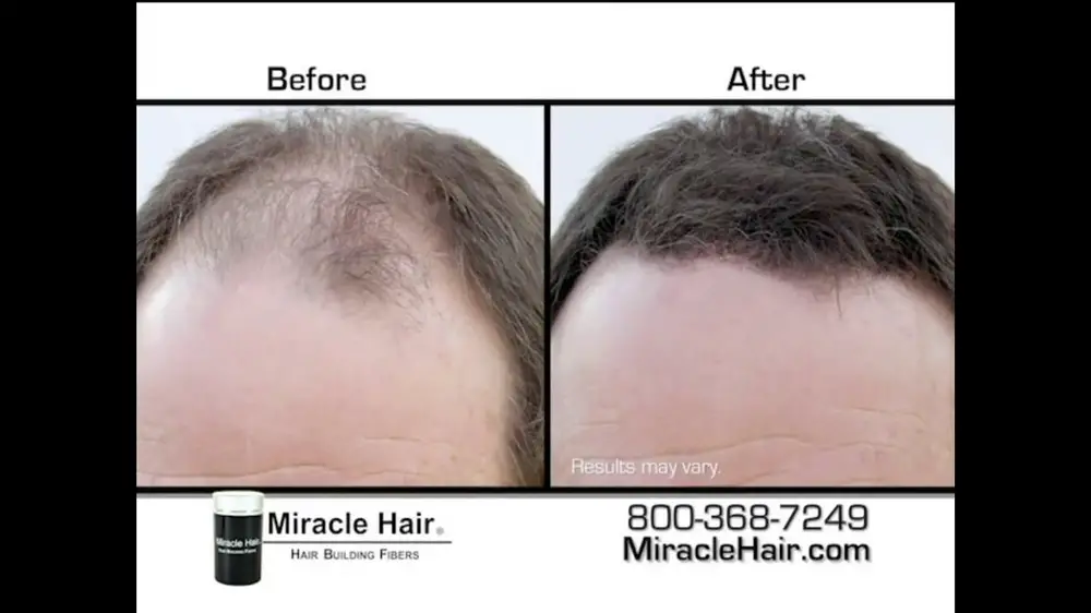 miracle-hair-transformation-large-3.jpg